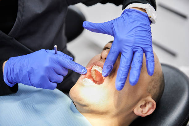 Best Emergency Wisdom Tooth Extraction in Mcconnelsville, OH