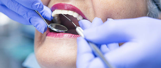 Best Broken or Chipped Tooth Repair in Mcconnelsville, OH